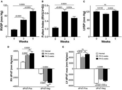 Echocardiographic, Biochemical, and Electrocardiographic Correlates Associated With Progressive Pulmonary Arterial Hypertension